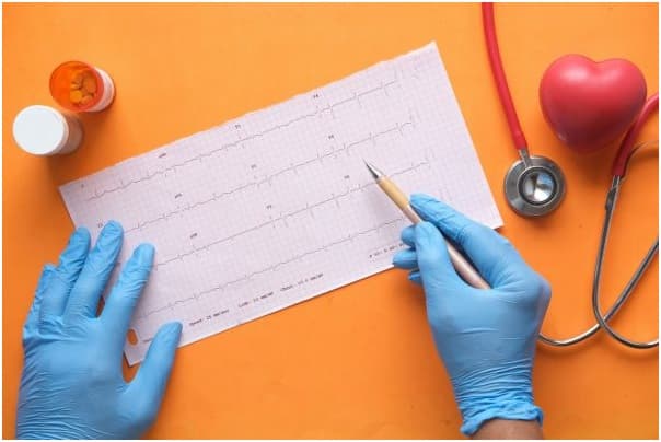 Representative Image of an electrocardiogram 