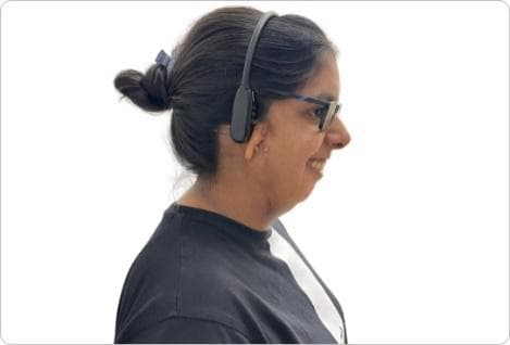 Person with Microtia