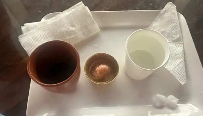Snehapana ghee detox at the Ayurvedic Retreat